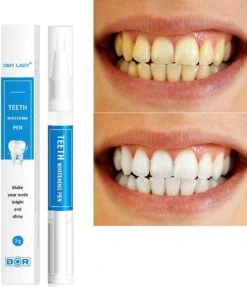 BOR Tanden Bleekpen - Tanden Bleken - Tandenbleekset - Whitening Pen - Tandenblekers - Wittere Tanden - Teeth Whitening Pen - Tanden Bleker 11 BOR Tanden Bleekpen - Tanden Bleken - Tandenbleekset - Whitening Pen - Tandenblekers - Wittere Tanden - Teeth Whitening Pen - Tanden Bleker -Winkel Voor Persoonlijke Verzorging 1031x1200 2