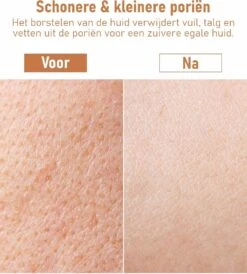 Fesio Lichaamsborstel Met Lange Steel - Dubbelzijdig - Dry Brushing Rugborstel/Badborstel/Doucheborstel/Huidborstel - 43 Cm -Winkel Voor Persoonlijke Verzorging 1080x1200 3