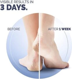 Scholl Klovenzalf - K+ Creme - Voor Hielkloven En Ruwe, Droge Huid 15 Scholl Klovenzalf - K+ Creme - Voor Hielkloven En Ruwe, Droge Huid -Winkel Voor Persoonlijke Verzorging 1094x1200 4