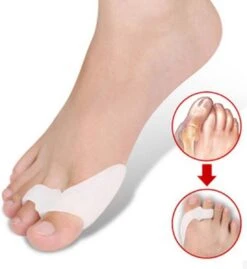 Now4You Hallux Valgus Siliconen Teenspreiders - 2 Stuks