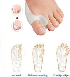 MYCARE+ Teencorrector - Wasbare Teencorrector - Gel-laag - 1 Paar - Pijn Verlichtend 13 MYCARE+ Teencorrector - Wasbare Teencorrector - Gel-laag - 1 Paar - Pijn Verlichtend -Winkel Voor Persoonlijke Verzorging 1102x1200 4