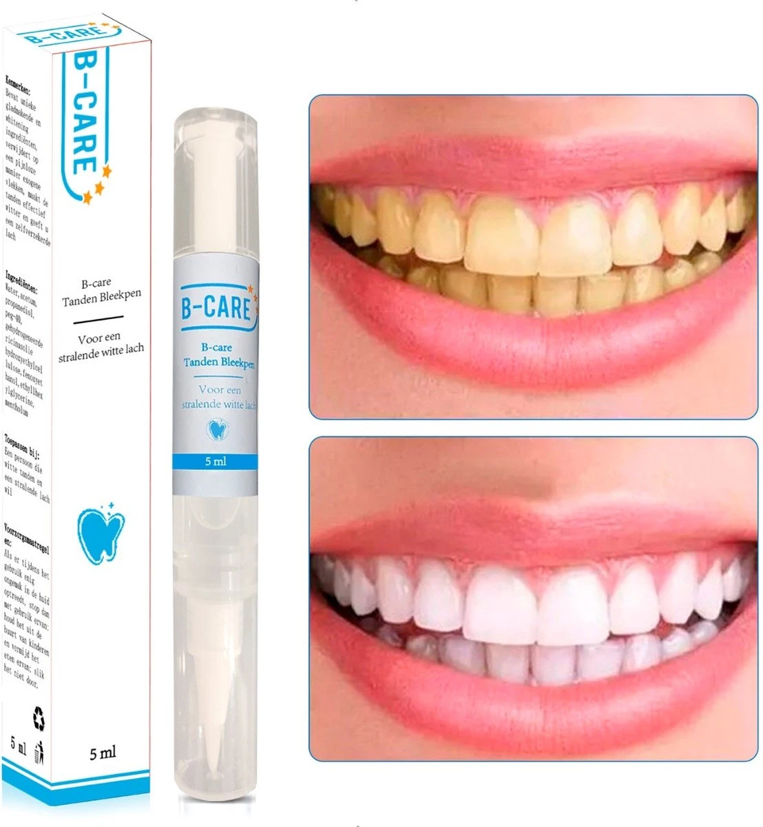 B-care Tanden Bleekpen - Teeth Whitening Pen - Tanden Bleker - Wittere Tanden - Teeth Whitening Strips - Professioneel Resultaat - Tandsteen Verwijderaar - Zonder Peroxide - Tandenbleekset - Tanden Bleken 3 B-care Tanden Bleekpen - Teeth Whitening Pen - Tanden Bleker - Wittere Tanden - Teeth Whitening Strips - Professioneel Resultaat - Tandsteen Verwijderaar - Zonder Peroxide - Tandenbleekset - Tanden Bleken