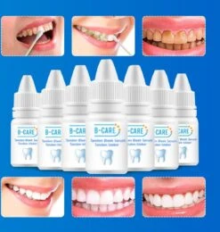 B-care Tanden Bleker – Wittere Tanden – Teeth Whitening Strips – Professioneel Resultaat - Tandsteen Verwijderaar - Zonder Peroxide - Tandenbleekset - Tanden Bleken -Winkel Voor Persoonlijke Verzorging 1138x1200 4