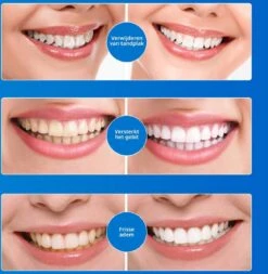 B-care Tanden Bleekpen - Teeth Whitening Pen - Tanden Bleker - Wittere Tanden - Teeth Whitening Strips - Professioneel Resultaat - Tandsteen Verwijderaar - Zonder Peroxide - Tandenbleekset - Tanden Bleken 20 B-care Tanden Bleekpen - Teeth Whitening Pen - Tanden Bleker - Wittere Tanden - Teeth Whitening Strips - Professioneel Resultaat - Tandsteen Verwijderaar - Zonder Peroxide - Tandenbleekset - Tanden Bleken -Winkel Voor Persoonlijke Verzorging 1170x1200 2
