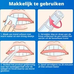 B-care Tanden Bleekpen - Teeth Whitening Pen - Tanden Bleker - Wittere Tanden - Teeth Whitening Strips - Professioneel Resultaat - Tandsteen Verwijderaar - Zonder Peroxide - Tandenbleekset - Tanden Bleken 16 B-care Tanden Bleekpen - Teeth Whitening Pen - Tanden Bleker - Wittere Tanden - Teeth Whitening Strips - Professioneel Resultaat - Tandsteen Verwijderaar - Zonder Peroxide - Tandenbleekset - Tanden Bleken -Winkel Voor Persoonlijke Verzorging 1185x1200 5