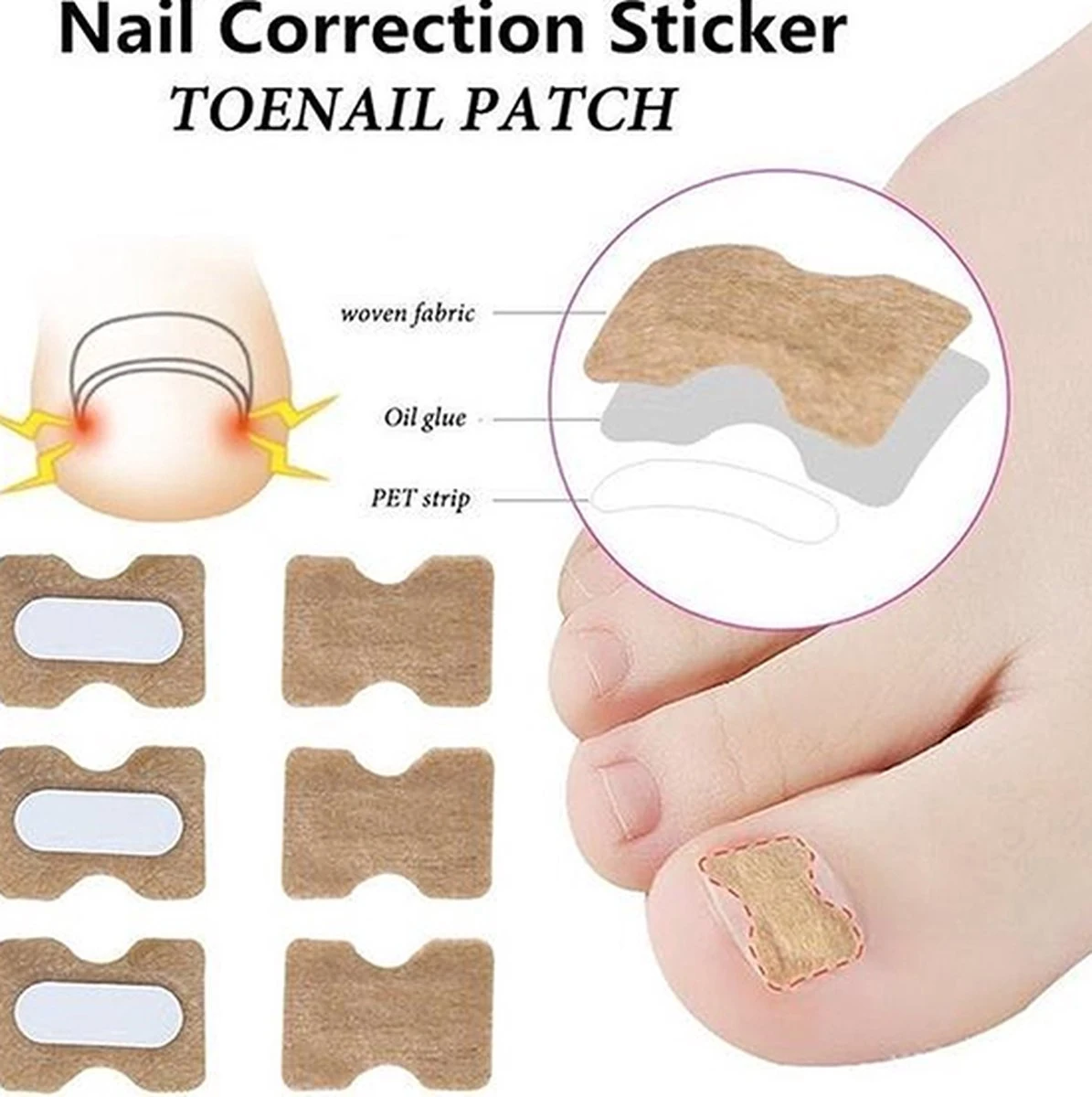 Teennagel Lifter I Ingegroeide Teennagel Corrector I Teennagel Pleister I Anti Ingroei Pleister I Nagel Correctie Kit I 30 Stuk 3 Teennagel Lifter I Ingegroeide Teennagel Corrector I Teennagel Pleister I Anti Ingroei Pleister I Nagel Correctie Kit I 30 Stuk