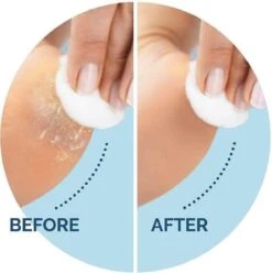 Scholl Velvet Smooth Voetvijl Wet & Dry - Starter - 1 Stuk 9 Scholl Velvet Smooth Voetvijl Wet & Dry - Starter - 1 Stuk -Winkel Voor Persoonlijke Verzorging 1196x1200 14