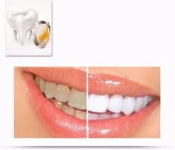 Merkloos Tanden Whitener Pen - Professionele Tandenbleek Gel - Tandenbleker -Winkel Voor Persoonlijke Verzorging 1200x1026 2