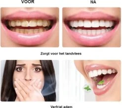 BOR Tanden Bleekpen - Tanden Bleken - Tandenbleekset - Whitening Pen - Tandenblekers - Wittere Tanden - Teeth Whitening Pen - Tanden Bleker 12 BOR Tanden Bleekpen - Tanden Bleken - Tandenbleekset - Whitening Pen - Tandenblekers - Wittere Tanden - Teeth Whitening Pen - Tanden Bleker -Winkel Voor Persoonlijke Verzorging 1200x1061 2