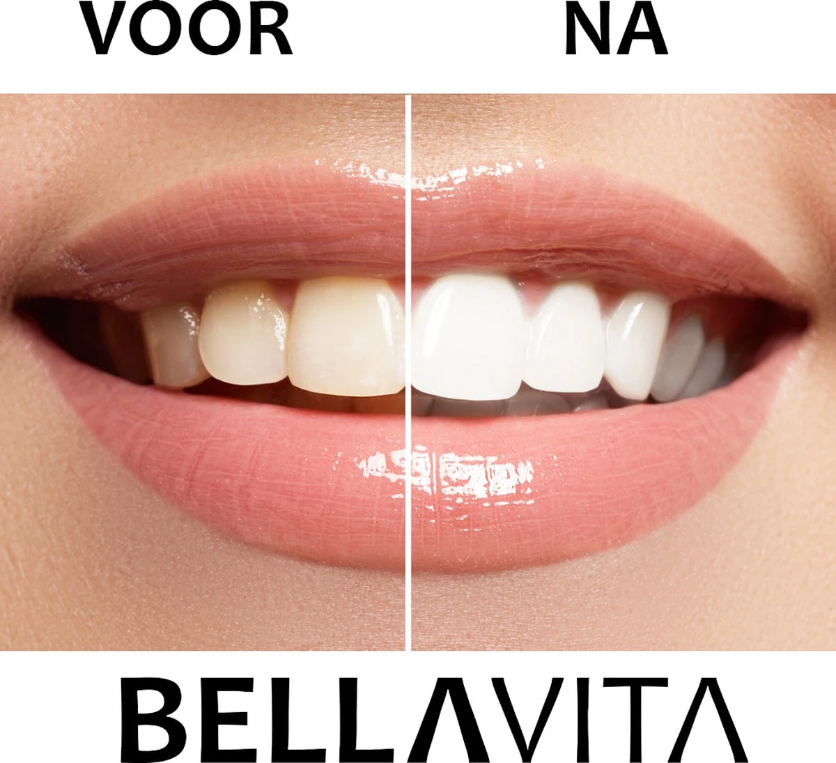 BELLAVITA Tandenbleekset - Tanden Bleken - Teeth Whitening Kit - Tandenblekers - 4 Gelpennen - Zonder Peroxide - 100% Natuurlijk - Witte Tanden 9 BELLAVITA Tandenbleekset - Tanden Bleken - Teeth Whitening Kit - Tandenblekers - 4 Gelpennen - Zonder Peroxide - 100% Natuurlijk - Witte Tanden - Afbeelding 7