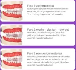 Edoir Rechte Tanden Beugel - Retainer Voor Rechte Tanden - Rechte Tanden Bitje 10 Edoir Rechte Tanden Beugel - Retainer Voor Rechte Tanden - Rechte Tanden Bitje -Winkel Voor Persoonlijke Verzorging 1200x1109