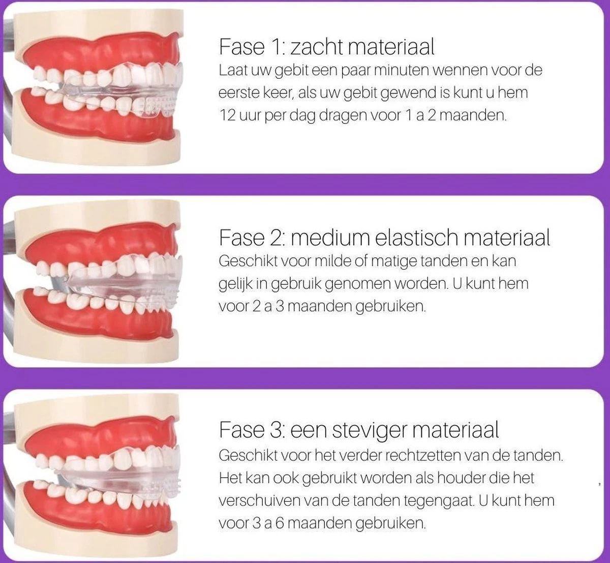 Edoir Rechte Tanden Beugel - Retainer Voor Rechte Tanden - Rechte Tanden Bitje 5 Edoir Rechte Tanden Beugel - Retainer Voor Rechte Tanden - Rechte Tanden Bitje - Afbeelding 3