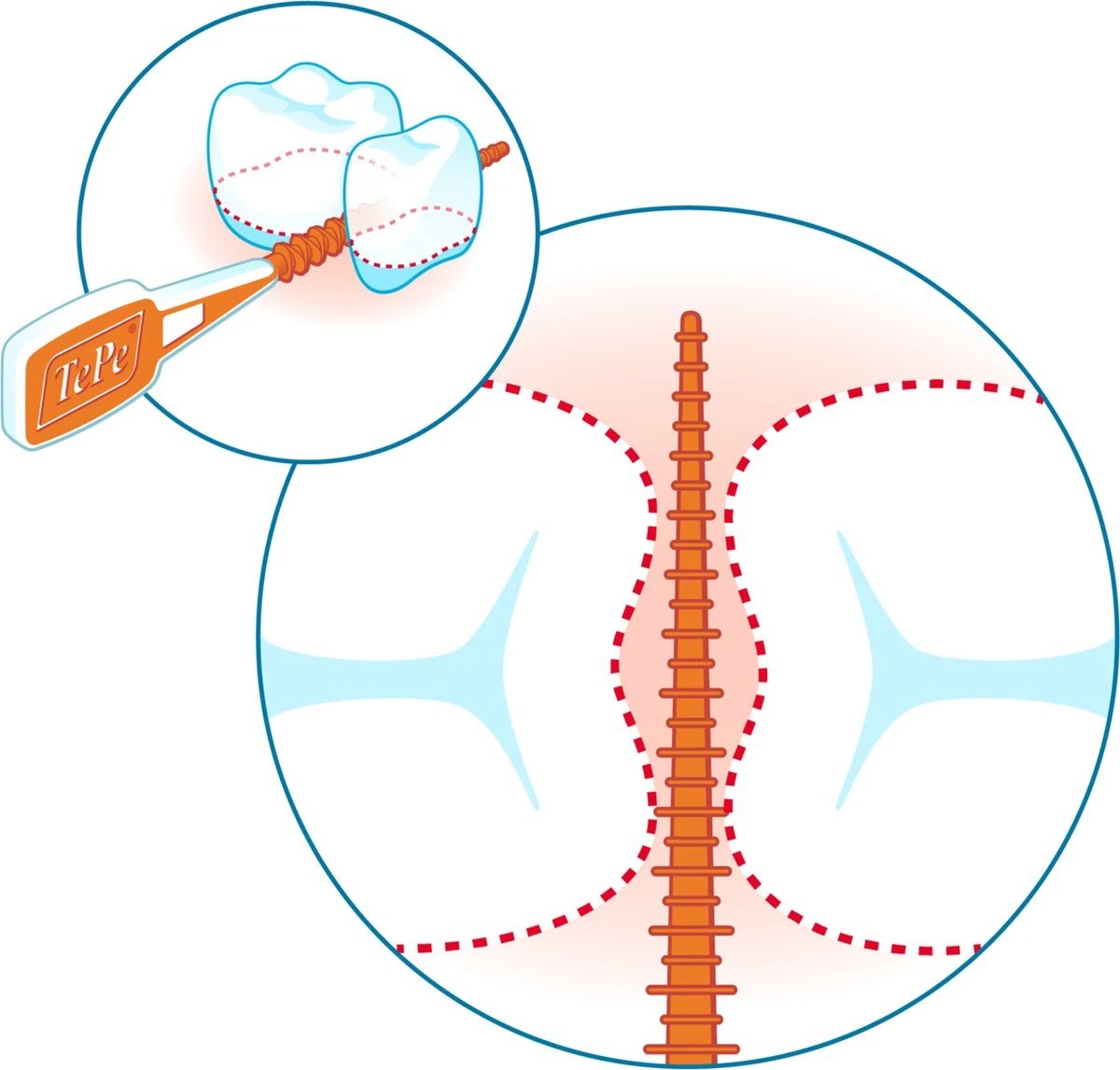 Tepe EasyPick Paars Maat XL – 36 Stuks 10 Tepe EasyPick Paars Maat XL – 36 Stuks - Afbeelding 8