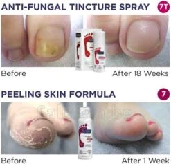 Footlogix Toe Nail Tincture Nagelspray 9 Footlogix Toe Nail Tincture Nagelspray -Winkel Voor Persoonlijke Verzorging 1200x1150 7