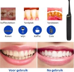 ExCorn Elektrische Tandsteen Verwijderaar - Inclusief 6-delig Tandartsset - 3 Standen - Elektrisch Tandplak Verwijderen - Tanden Polijsten -Winkel Voor Persoonlijke Verzorging 1200x1173 1