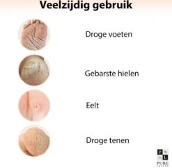 PureLuxure Voetmasker - Voetverzorging - Eeltsokken - Eelt Verwijderaar - Voetenmasker - Peel Off Masker - 1 Paar (2 Stuks) -Winkel Voor Persoonlijke Verzorging 1200x1174