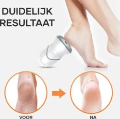 MW® Elektrische Eeltverwijderaar - Voetvijl - Eelt Verwijderaar - Elektrische Vijl - 3 Vijlschijven -Winkel Voor Persoonlijke Verzorging 1200x1191 8