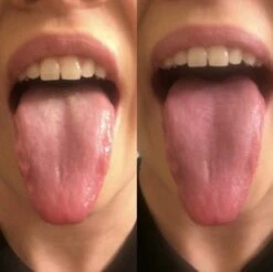 Orabrush Tongreiniger -Winkel Voor Persoonlijke Verzorging 1200x1197 4