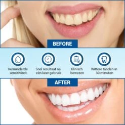 V-Goods Premium Whitening Strips - Tandenbleek Strips - Wittere Tanden - 28x Tandenbleek Strips DIRECT Resultaat - Tandenbleekset - Whitening - Tandenblekers 12 V-Goods Premium Whitening Strips - Tandenbleek Strips - Wittere Tanden - 28x Tandenbleek Strips DIRECT Resultaat - Tandenbleekset - Whitening - Tandenblekers -Winkel Voor Persoonlijke Verzorging 1200x1199 7