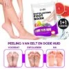1+1 Gratis - Eeltverwijderaars - Voetmasker - Eeltsokken Peeling Sokken - Eeltverwijderaars - Voetmasker