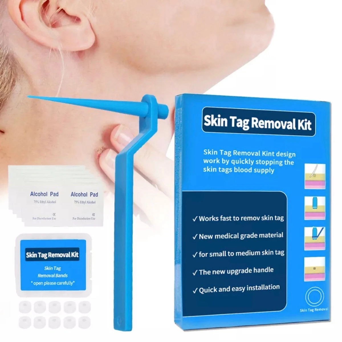 Steelwratjes Verwijderaar - Steelwratjes Verwijderen - Pijnloos En Snel - Wrattenverwijderaar - Steelwratten 3 Steelwratjes Verwijderaar - Steelwratjes Verwijderen - Pijnloos En Snel - Wrattenverwijderaar - Steelwratten