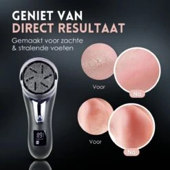 Beeperfect® Elektrische Eeltverwijderaar Met Stofzuigsysteem - Voetvijl - Eeltvijl - IPX7 Waterdicht - Gratis Pedicure Set - Zwart -Winkel Voor Persoonlijke Verzorging 1200x1200 1772