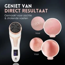 Beeperfect® Elektrische Eeltverwijderaar Met Stofzuigsysteem - Voetvijl - Eeltvijl - IPX7 Waterdicht - Gratis Pedicure Set -Winkel Voor Persoonlijke Verzorging 1200x1200 1796