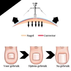 7-delige Pedicure En Manicure Set - Nagelknipper - Pedicureset - Nagelvijl - Nageltang - Kalknagel - Teennagelknipper -Winkel Voor Persoonlijke Verzorging 1200x1200 1812