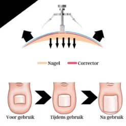 7-Delige Pedicure Set - Nagelverzorging - Nagelset - Ingegroeide Teennagel - Nagelknipper - Nail Clippers - Ingrown Toenail -Winkel Voor Persoonlijke Verzorging 1200x1200 2080