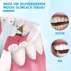 DEN-T® PRO P350 Elektrische Tandenpolijster - Wit - 5 Standen - 5 Opzetstukken - Polijstmachine - Polijstset - Tanden Polijsten - 14 DEN-T® PRO P350 Elektrische Tandenpolijster - Wit - 5 Standen - 5 Opzetstukken - Polijstmachine - Polijstset - Tanden Polijsten - -Winkel Voor Persoonlijke Verzorging 1200x1200 309