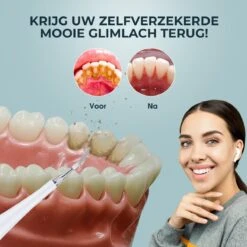 Merkloos Tandsteen Verwijderaar Elektrisch – Tandenborstel Opzetstukken - Tandarts Spiegel - 5 Standen -Wit -Winkel Voor Persoonlijke Verzorging 1200x1200 427