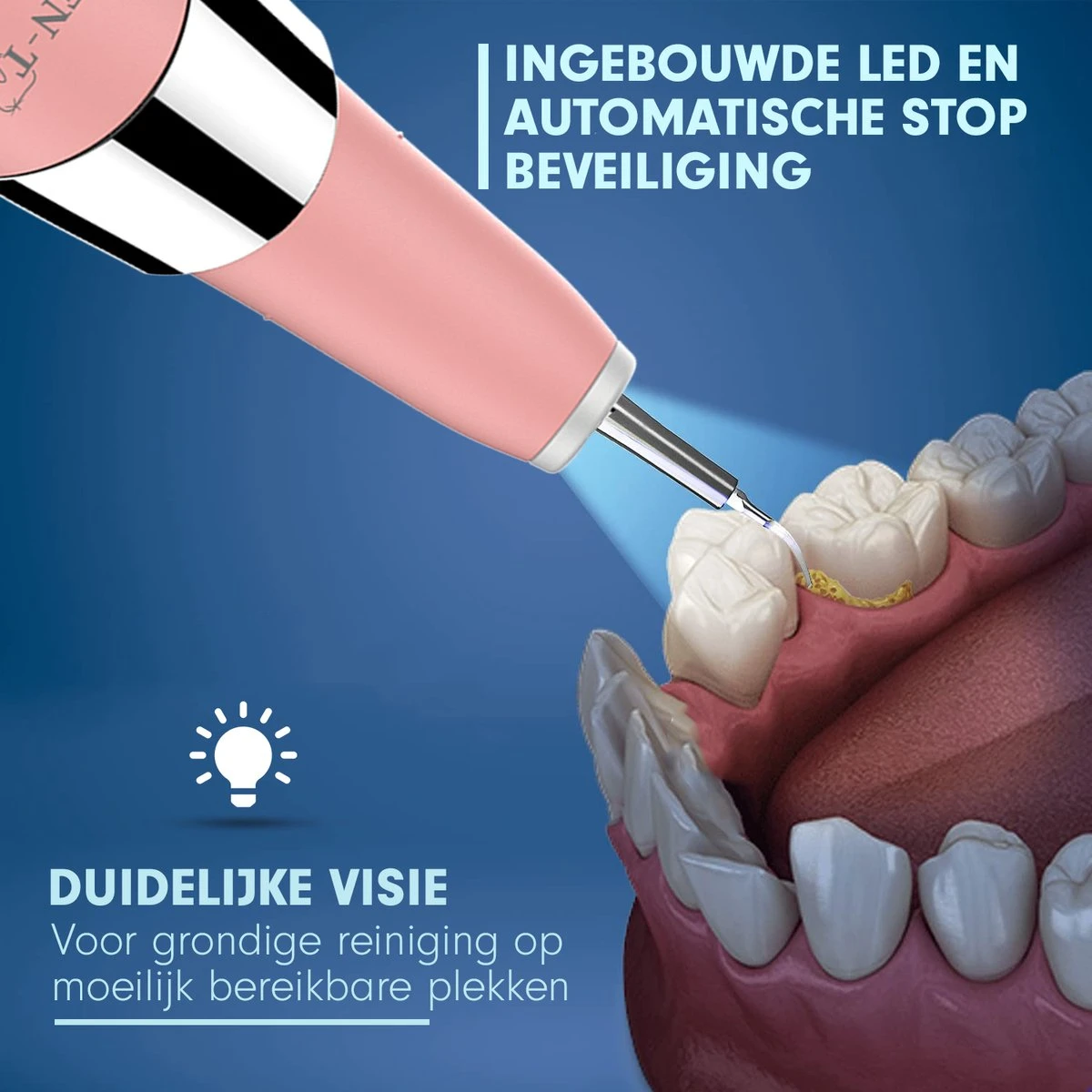 DEN-T® PRO U500 - Elektrische Sonische Tandsteen Verwijderaar - Roze 5 DEN-T® PRO U500 - Elektrische Sonische Tandsteen Verwijderaar - Roze - Afbeelding 3