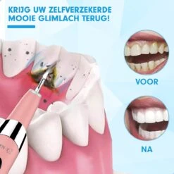 DEN-T® PRO U500 - Elektrische Sonische Tandsteen Verwijderaar - Roze 20 DEN-T® PRO U500 - Elektrische Sonische Tandsteen Verwijderaar - Roze -Winkel Voor Persoonlijke Verzorging 1200x1200 462