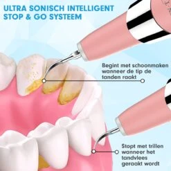 DEN-T® PRO U500 - Elektrische Sonische Tandsteen Verwijderaar - Roze 22 DEN-T® PRO U500 - Elektrische Sonische Tandsteen Verwijderaar - Roze -Winkel Voor Persoonlijke Verzorging 1200x1200 464