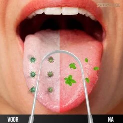 SolidStock Professionele Tongschraper Voor Mondverzorging - 4 Delige Tongreiniger - Ayurveda - RVS 14 SolidStock Professionele Tongschraper Voor Mondverzorging - 4 Delige Tongreiniger - Ayurveda - RVS -Winkel Voor Persoonlijke Verzorging 1200x1200 546