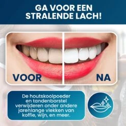 Tandenbleekset - Teeth Whitening - Teeth Whitener - Wittere Tanden - Tanden Bleken - Direct Resultaat - Zelfde Effect Als Whitening Strips 12 Tandenbleekset - Teeth Whitening - Teeth Whitener - Wittere Tanden - Tanden Bleken - Direct Resultaat - Zelfde Effect Als Whitening Strips -Winkel Voor Persoonlijke Verzorging 1200x1200 605