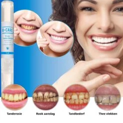 B-care Tanden Bleekpen - Teeth Whitening Pen - Tanden Bleker - Wittere Tanden - Teeth Whitening Strips - Professioneel Resultaat - Tandsteen Verwijderaar - Zonder Peroxide - Tandenbleekset - Tanden Bleken 19 B-care Tanden Bleekpen - Teeth Whitening Pen - Tanden Bleker - Wittere Tanden - Teeth Whitening Strips - Professioneel Resultaat - Tandsteen Verwijderaar - Zonder Peroxide - Tandenbleekset - Tanden Bleken -Winkel Voor Persoonlijke Verzorging 1200x1200 643