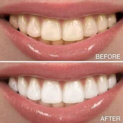 Perfect Wit - Whitening Pen - Tandenblekers - 100% Natuurlijke Ingrediënten - Peroxidevrij - Veilig Bleken - Witte Tanden - Tandbleekset - Tanden Bleken - Whitening - Teeth Whitening - Frisse Adem 16 Perfect Wit - Whitening Pen - Tandenblekers - 100% Natuurlijke Ingrediënten - Peroxidevrij - Veilig Bleken - Witte Tanden - Tandbleekset - Tanden Bleken - Whitening - Teeth Whitening - Frisse Adem -Winkel Voor Persoonlijke Verzorging 1200x1200 646