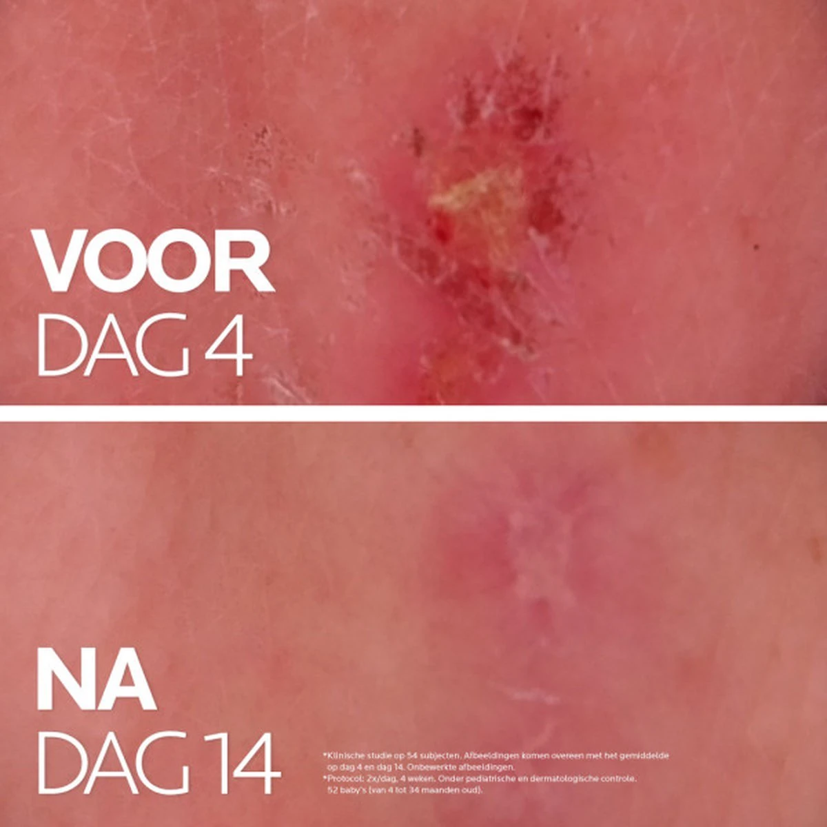 La Roche-Posay Cicaplast Balsem B5+ - 40ml - Voor Gevoelige Huid - Helpt De Huid Herstellen 12 La Roche-Posay Cicaplast Balsem B5+ - 40ml - Voor Gevoelige Huid - Helpt De Huid Herstellen - Afbeelding 10