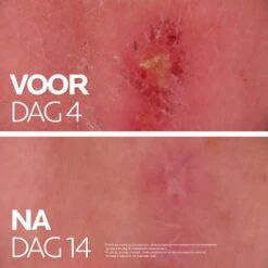 La Roche-Posay Cicaplast Balsem B5+ - 100ml - Voor Gevoelige Huid 20 La Roche-Posay Cicaplast Balsem B5+ - 100ml - Voor Gevoelige Huid -Winkel Voor Persoonlijke Verzorging 1200x1200 975