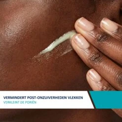 CeraVe Resurfacing Retinol Serum - 30ml - Voor Onzuivere Huid Met Neiging Tot Acne 17 CeraVe Resurfacing Retinol Serum - 30ml - Voor Onzuivere Huid Met Neiging Tot Acne -Winkel Voor Persoonlijke Verzorging 1200x1200 978