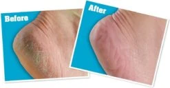 O'Keeffe's - Voetencreme - Voor Gezonde Voeten - Potje 96 Gram -Winkel Voor Persoonlijke Verzorging 1200x622