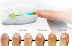 Anti Schimmelnagel Kalknagel Laserapparaat Om Zelf Te Behandelen, Veilig, Effectief, Snel En Pijnloos, Koude Laser Behandeling Voor Thuisgebruik, Voor Tenen En Vingers. Oplaadbaar. -Winkel Voor Persoonlijke Verzorging 1200x774 1