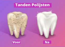 Merkloos HQ Tooth Polisher - Tanden Polijsten - Wittere Tanden - Tandsteen Tandplak Verwijderaar - Elektrisch 13 Merkloos HQ Tooth Polisher - Tanden Polijsten - Wittere Tanden - Tandsteen Tandplak Verwijderaar - Elektrisch -Winkel Voor Persoonlijke Verzorging 1200x886 3