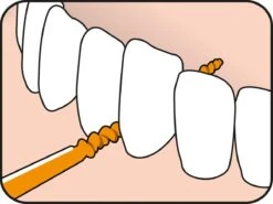 Tepe EasyPick Oranje Maat XS/S – 36 Stuks -Winkel Voor Persoonlijke Verzorging 1200x897