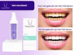 Glory Of White V34 Serum - Kleurcorrector - Witte Tanden - Tandpasta - Tanden Reinigen - Teeth Whitening - 30ML -Winkel Voor Persoonlijke Verzorging 1200x899 5