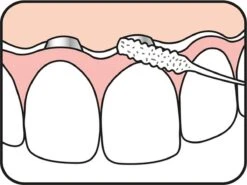 Tepe Floss Bridge & Implant 30 St 15 Tepe Floss Bridge & Implant 30 St -Winkel Voor Persoonlijke Verzorging 1200x901 1