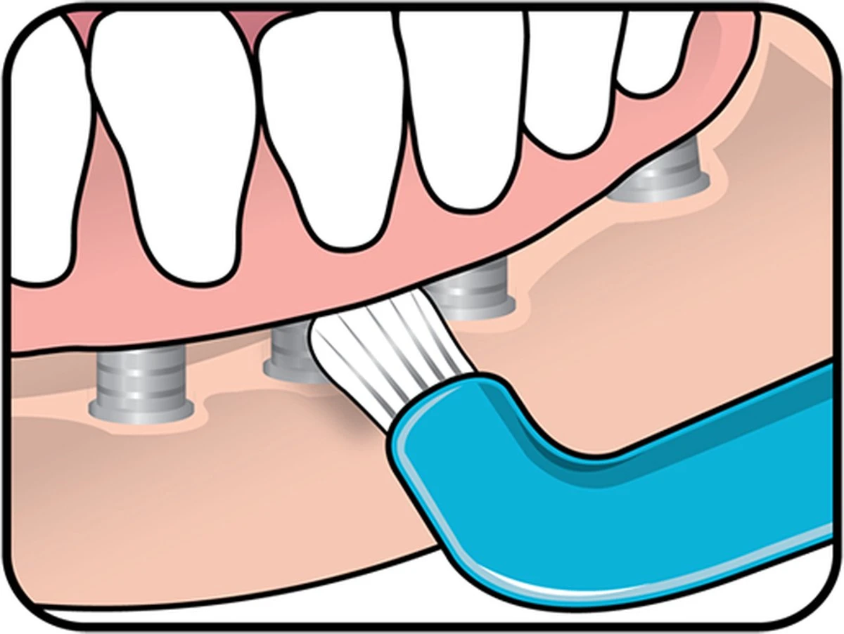 TePe Compact Tuft - Single Tufted Borstel - Tandenborstel 17 TePe Compact Tuft - Single Tufted Borstel - Tandenborstel - Afbeelding 15