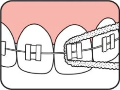 Tepe Floss Bridge & Implant 30 St 16 Tepe Floss Bridge & Implant 30 St -Winkel Voor Persoonlijke Verzorging 1200x902 10