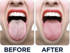 JuliBrite Tong Gel (50 ML) Tongreinigende Gel - Verfrist De Adem - Schone Tong -Winkel Voor Persoonlijke Verzorging 1200x914